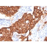 Immunohistochemistry - Anti-HER2 Antibody [ERBB2/4439] (A248459) - Antibodies.com