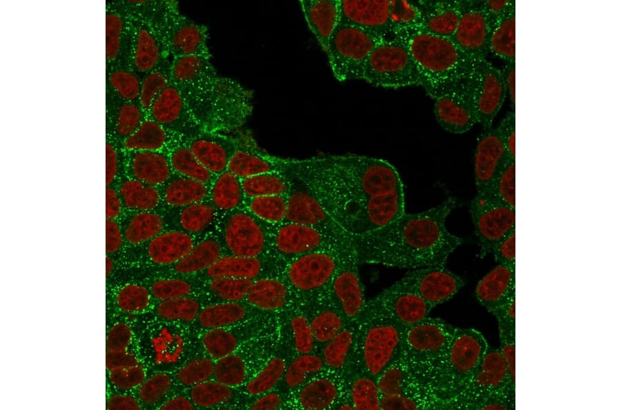 Immunofluorescence - Anti-HER2 Antibody [ERBB2/4439] (A248459) - Antibodies.com