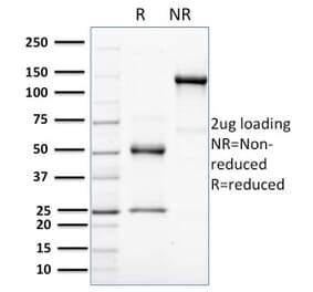 SDS-PAGE - Anti-HER4 Antibody [HFR-1] (A248461) - Antibodies.com