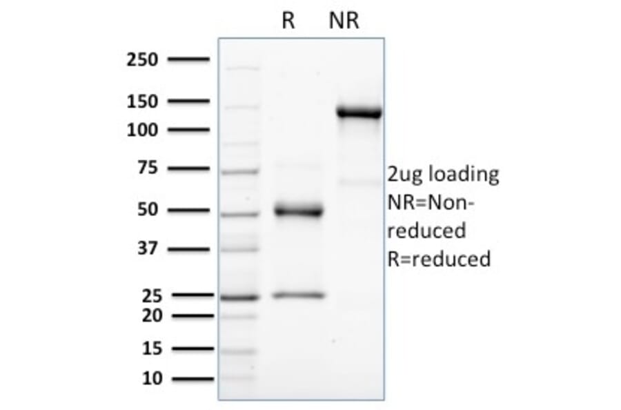 SDS-PAGE - Anti-HER4 Antibody [HFR-1] (A248461) - Antibodies.com