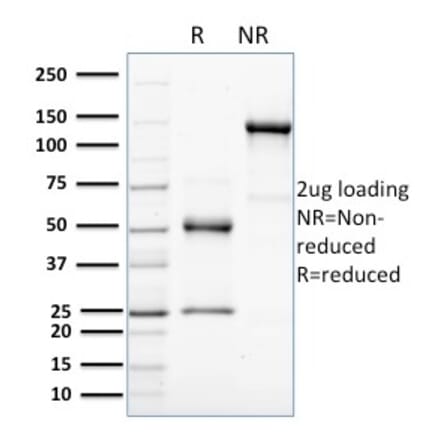 SDS-PAGE - Anti-HER4 Antibody [HFR-1] (A248461) - Antibodies.com