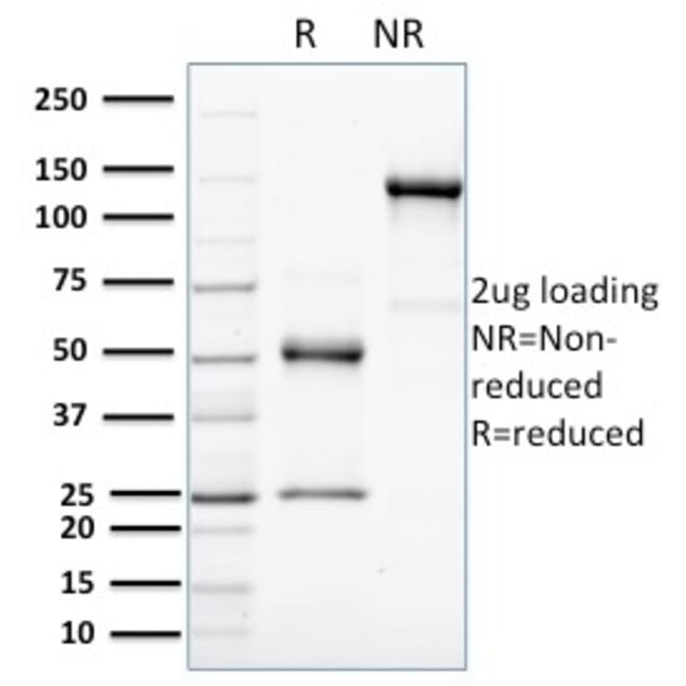 SDS-PAGE - Anti-HER4 Antibody [HFR-1] (A248461) - Antibodies.com