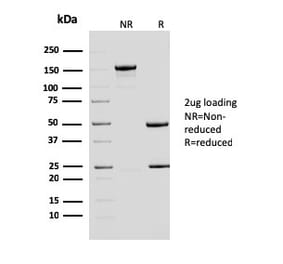 SDS-PAGE - Anti-ERCC1 Antibody [ERCC1/2683] (A248463) - Antibodies.com