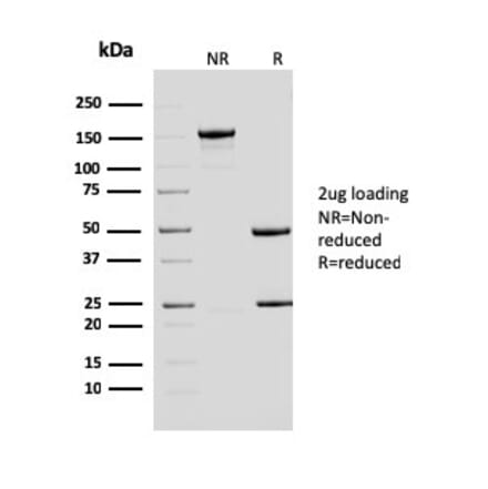 SDS-PAGE - Anti-ERCC1 Antibody [ERCC1/2683] (A248463) - Antibodies.com