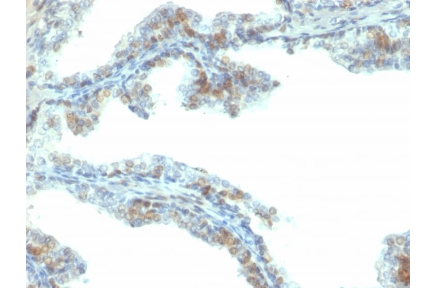 Immunohistochemistry - Anti-ERG Antibody [ERG/2107] (A248464) - Antibodies.com