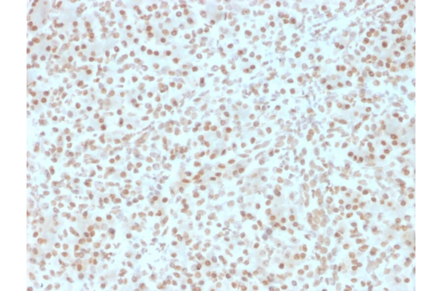 Immunohistochemistry - Anti-AKT1 Antibody [AKT1/2491] (A248466) - Antibodies.com