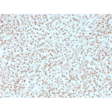 Immunohistochemistry - Anti-AKT1 Antibody [AKT1/2491] (A248466) - Antibodies.com