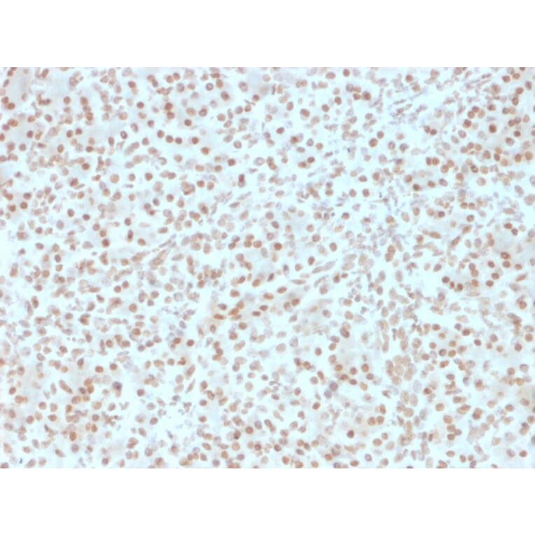 Immunohistochemistry - Anti-AKT1 Antibody [AKT1/2491] (A248466) - Antibodies.com