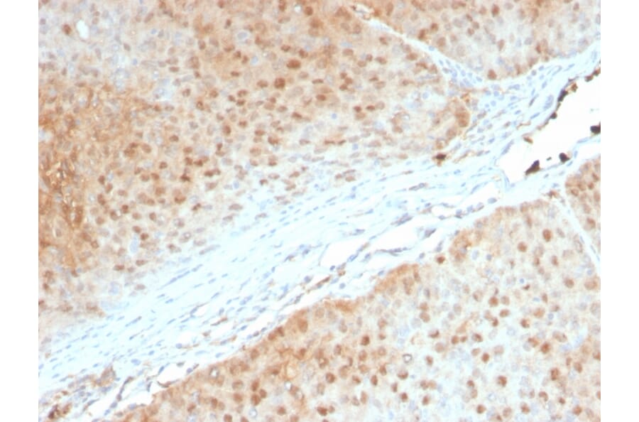 Immunohistochemistry - Anti-AKT1 Antibody [AKT1/2552] (A248467) - Antibodies.com