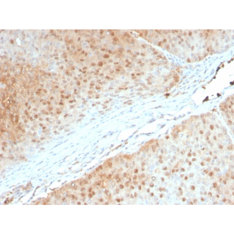 Immunohistochemistry - Anti-AKT1 Antibody [AKT1/2552] (A248467) - Antibodies.com