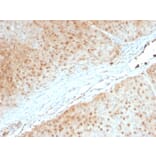 Immunohistochemistry - Anti-AKT1 Antibody [AKT1/2552] (A248467) - Antibodies.com