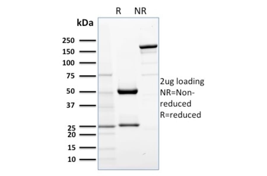 SDS-PAGE - Anti-AKT1 Antibody [AKT1/2552] (A248467) - Antibodies.com