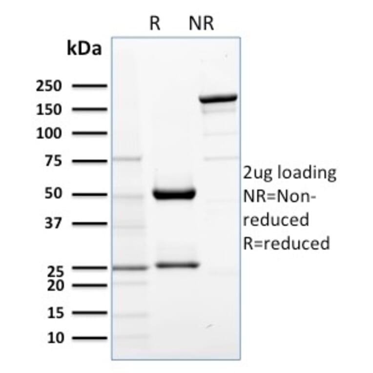 SDS-PAGE - Anti-AKT1 Antibody [AKT1/2552] (A248467) - Antibodies.com