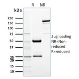 SDS-PAGE - Anti-AKT1 Antibody [AKT1/2552] (A248467) - Antibodies.com