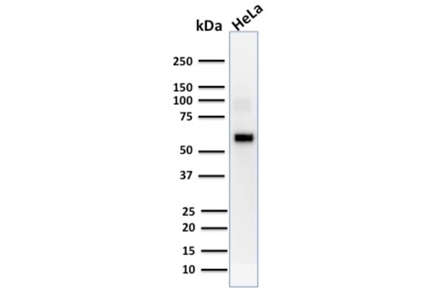 Western Blot - Anti-AKT1 Antibody [AKT1/2552] (A248467) - Antibodies.com