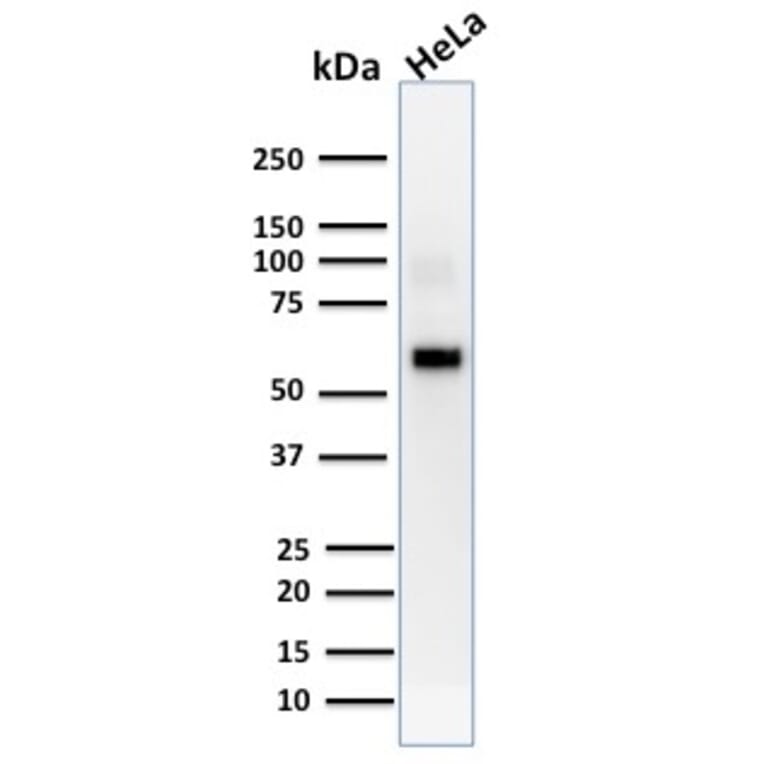 Western Blot - Anti-AKT1 Antibody [AKT1/2552] (A248467) - Antibodies.com