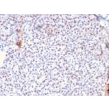 Immunohistochemistry - Anti-AKT1 Antibody [AKT1/2784] (A248468) - Antibodies.com