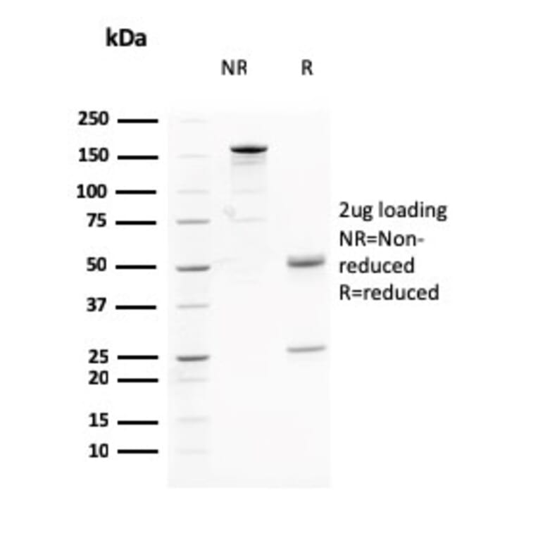 SDS-PAGE - Anti-AKT1 Antibody [AKT1/2784] (A248468) - Antibodies.com