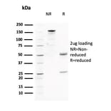 SDS-PAGE - Anti-AKT1 Antibody [AKT1/2784] (A248468) - Antibodies.com