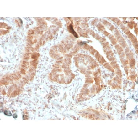 Immunohistochemistry - Anti-AKT1 Antibody [rAKT1/2491] (A248468) - Antibodies.com