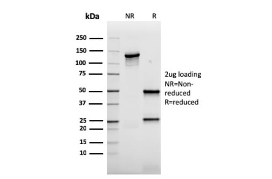 SDS-PAGE - Anti-AKT1 Antibody [rAKT1/2491] (A248469) - Antibodies.com