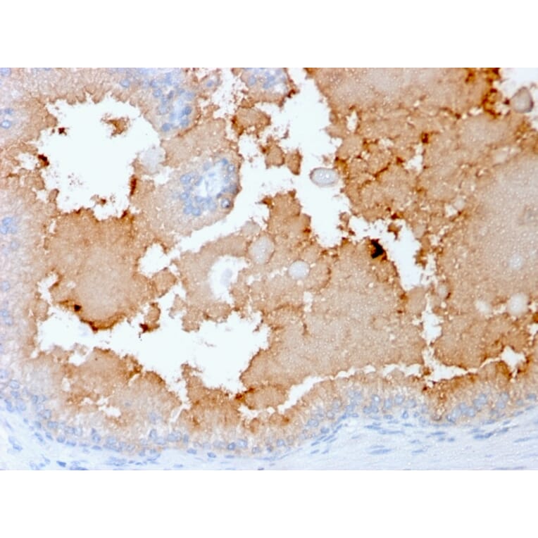 Immunohistochemistry - Anti-AKT1 Antibody [rAKT1/2491] (A248469) - Antibodies.com