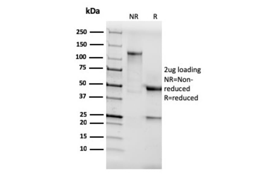 SDS-PAGE - Anti-AKT1 Antibody [AKT1/3898R] (A248469) - Antibodies.com