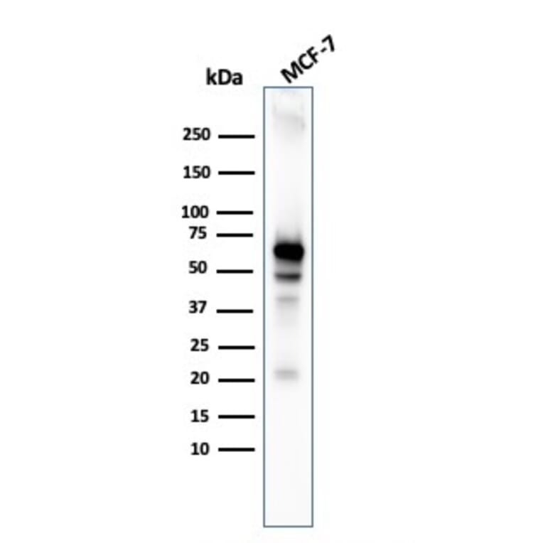 Western Blot - Anti-AKT1 Antibody [AKT1/3898R] (A248470) - Antibodies.com
