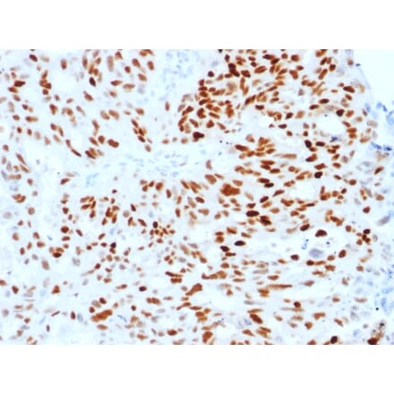 Immunohistochemistry - Anti-Estrogen Receptor alpha Antibody [ESR1/1904] (A248471) - Antibodies.com