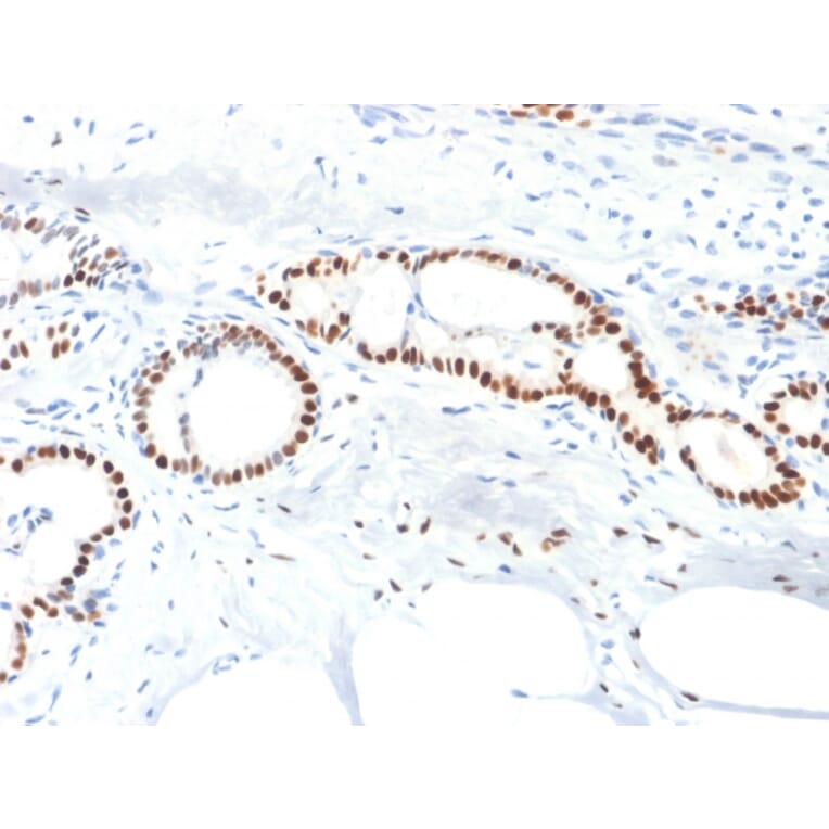 Immunohistochemistry - Anti-Estrogen Receptor alpha Antibody [ESR1/1904] (A248471) - Antibodies.com