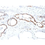 Immunohistochemistry - Anti-Estrogen Receptor alpha Antibody [ESR1/1904] (A248471) - Antibodies.com