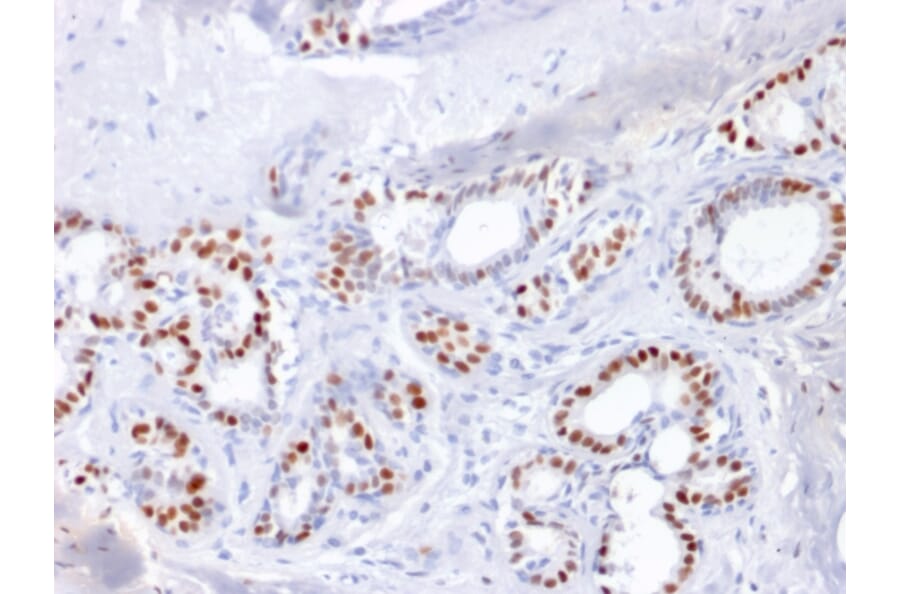 Immunohistochemistry - Anti-Estrogen Receptor alpha Antibody [ESR1/1904] (A248471) - Antibodies.com