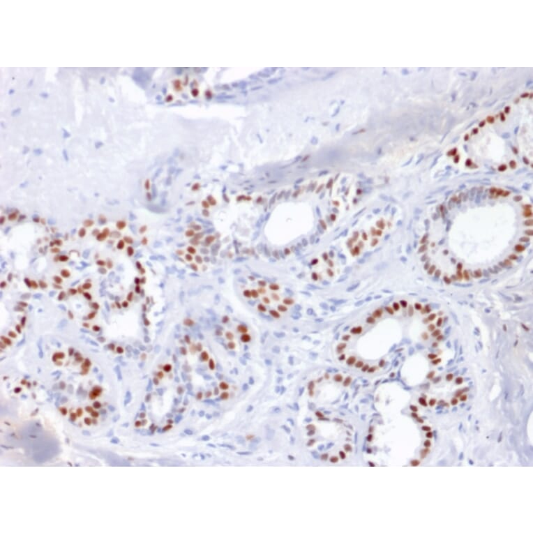 Immunohistochemistry - Anti-Estrogen Receptor alpha Antibody [ESR1/1904] (A248471) - Antibodies.com
