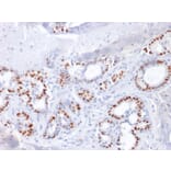 Immunohistochemistry - Anti-Estrogen Receptor alpha Antibody [ESR1/1904] (A248471) - Antibodies.com