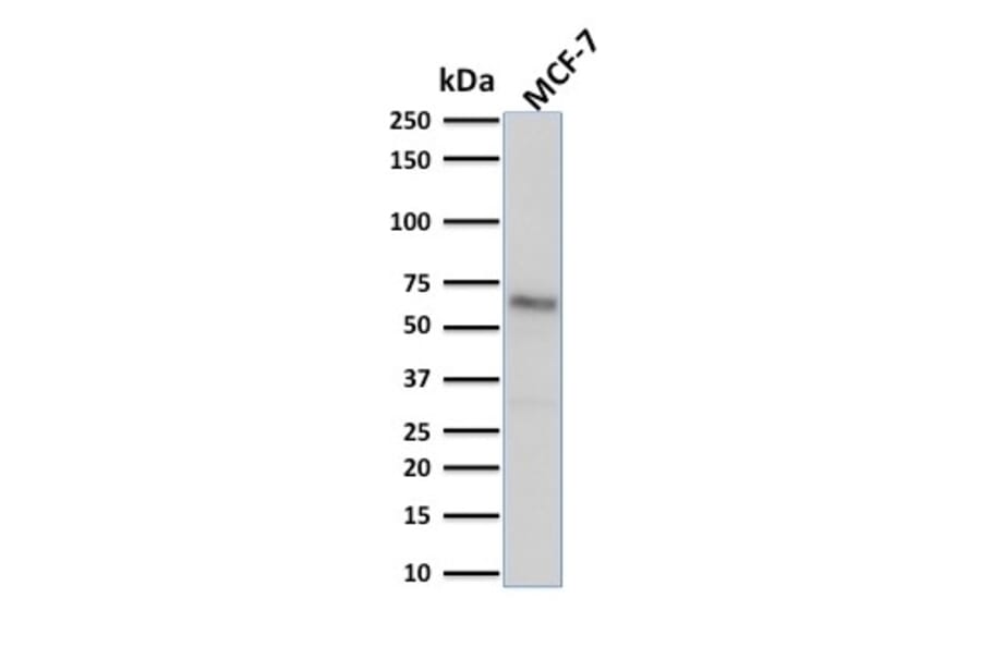 Western Blot - Anti-Estrogen Receptor alpha Antibody [ESR1/1904] (A248471) - Antibodies.com