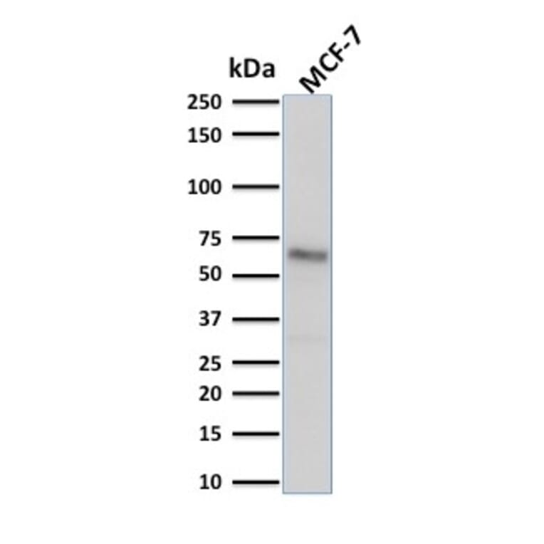 Western Blot - Anti-Estrogen Receptor alpha Antibody [ESR1/1904] (A248471) - Antibodies.com