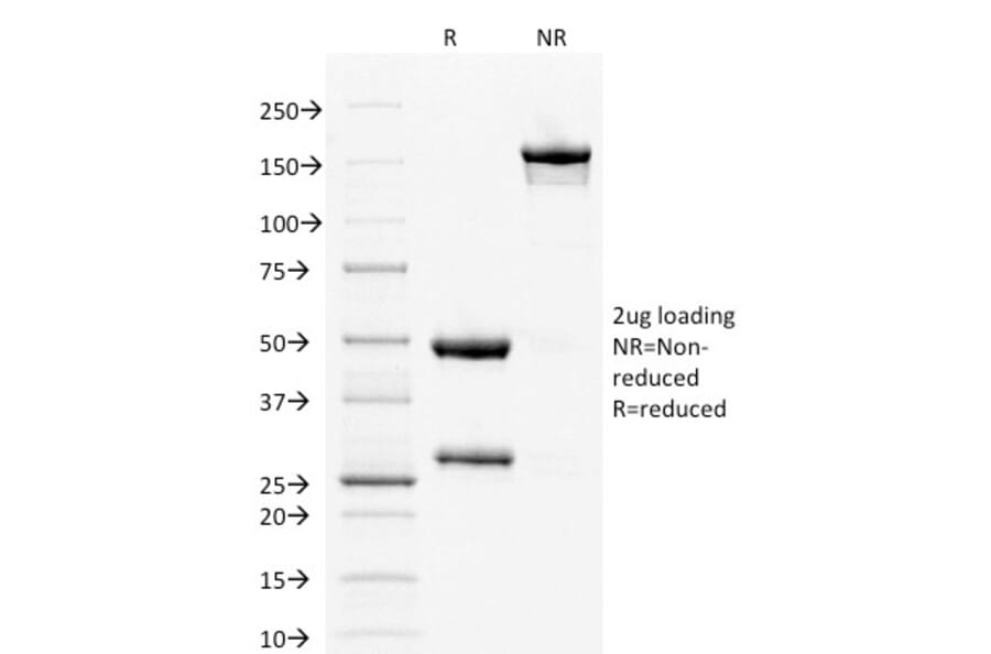 SDS-PAGE - Anti-Estrogen Receptor alpha Antibody [ESR1/1904] (A248471) - Antibodies.com