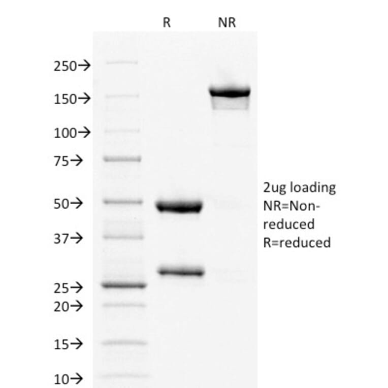 SDS-PAGE - Anti-Estrogen Receptor alpha Antibody [ESR1/1904] (A248471) - Antibodies.com