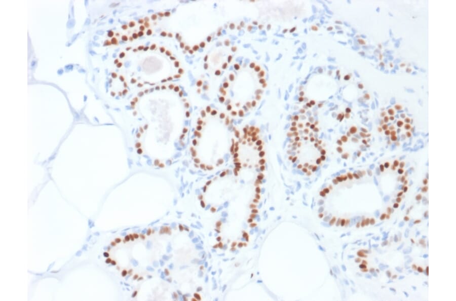 Immunohistochemistry - Anti-Estrogen Receptor alpha Antibody [ESR1/1935] (A248472) - Antibodies.com
