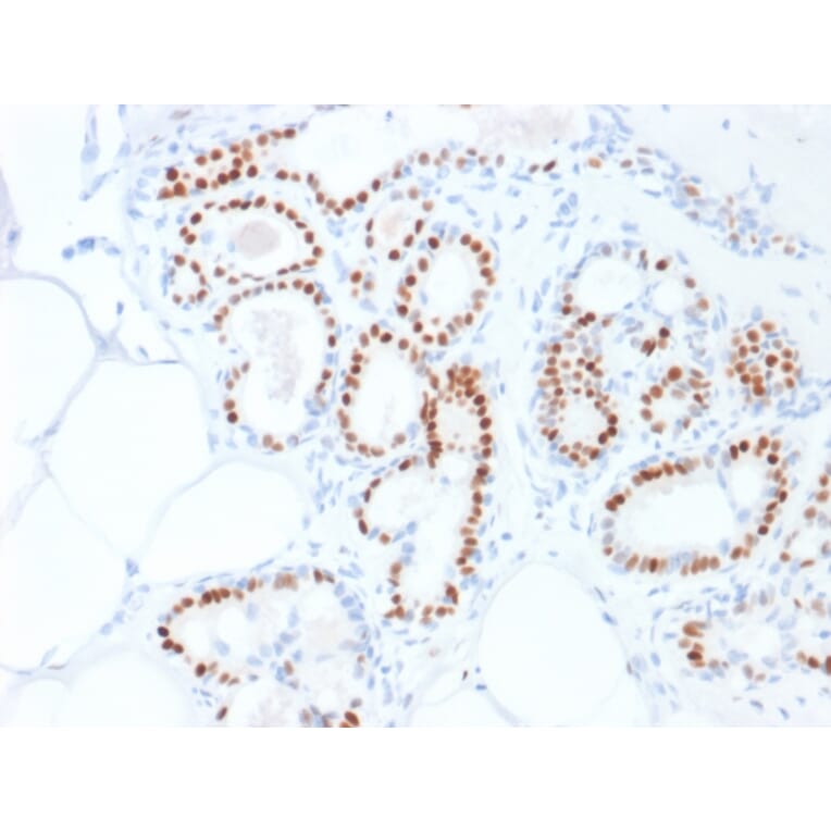 Immunohistochemistry - Anti-Estrogen Receptor alpha Antibody [ESR1/1935] (A248472) - Antibodies.com