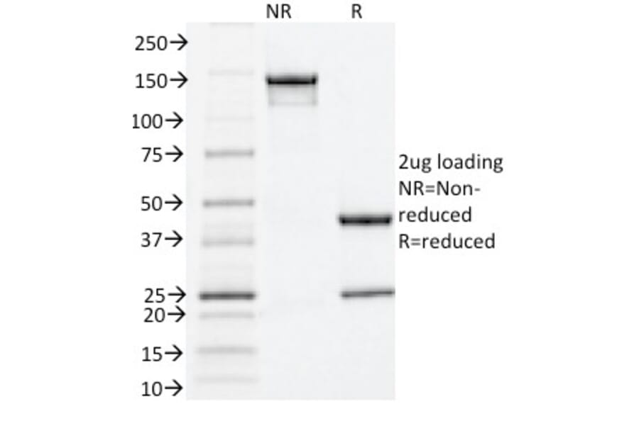 SDS-PAGE - Anti-Estrogen Receptor alpha Antibody [ESR1/1935] (A248472) - Antibodies.com