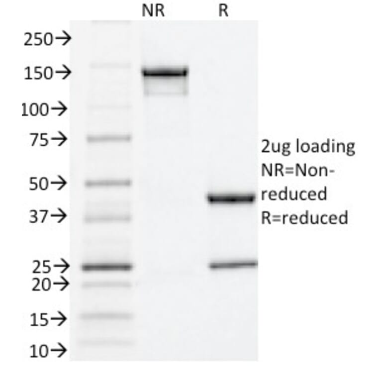 SDS-PAGE - Anti-Estrogen Receptor alpha Antibody [ESR1/1935] (A248472) - Antibodies.com