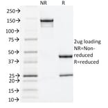 SDS-PAGE - Anti-Estrogen Receptor alpha Antibody [ESR1/1935] (A248472) - Antibodies.com