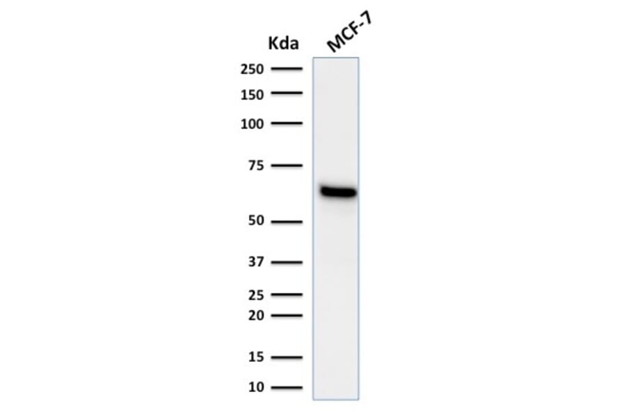 Western Blot - Anti-Estrogen Receptor alpha Antibody [ESR1/1935] (A248472) - Antibodies.com