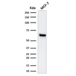 Western Blot - Anti-Estrogen Receptor alpha Antibody [ESR1/1935] (A248472) - Antibodies.com