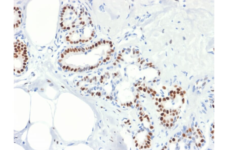 Immunohistochemistry - Anti-Estrogen Receptor alpha Antibody [rESR1/1935] (A248472) - Antibodies.com