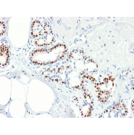 Immunohistochemistry - Anti-Estrogen Receptor alpha Antibody [rESR1/1935] (A248472) - Antibodies.com