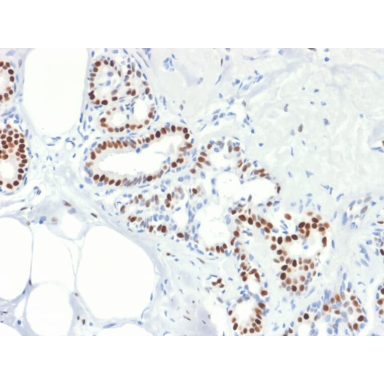 Immunohistochemistry - Anti-Estrogen Receptor alpha Antibody [rESR1/1935] (A248472) - Antibodies.com