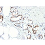 Immunohistochemistry - Anti-Estrogen Receptor alpha Antibody [rESR1/1935] (A248472) - Antibodies.com