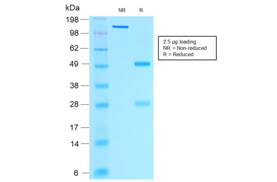 SDS-PAGE - Anti-Estrogen Receptor alpha Antibody [rESR1/1935] (A248473) - Antibodies.com